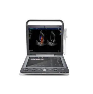 Sonoscape S 9V Geavanceerde Dierlijke Zwangerschap Echografie Apparatuur Met Kristalheldere Kleurenbeelden Touchscreen Veterinair Instrument