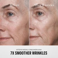 Ensemble de crèmes pour le visage anti-âge au collagène pour femmes, marque privée coréenne, produits de soin de la peau à la perle, acide hyaluronique, soin éclaircissant de la peau