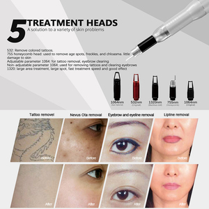 Máquina de Depilación Láser Nd Yag Q-Switched, <span class=keywords><strong>Precio</strong></span> de Láser de Diodo, Láser para Eliminación de Tatuajes - Product Image 6