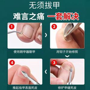 Kit de coupe-ongles, outils de pédicure, coupe-ongles pour les pieds, coupe-ongles, pinces, ciseaux anti-inflammatoires domestiques, vente en gros - Product Image 3