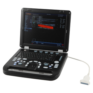 SUN-906C pour appareil d'échographie Doppler couleur 4D vétérinaire professionnel avec écran LED de 15 pouces et sonde à 192 éléments - Product Image 2
