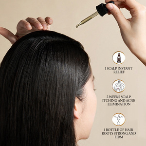 Aceite Capilar Orgánico 100% Natural de Marca Privada para el Crecimiento del Cabello, Tratamiento Vegano Reparador con Romero, Aceite Capilar Anticaída - Product Image 3