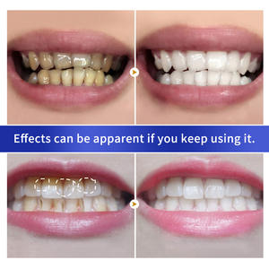 Отбеливающий порошок для зубов BREYLEE, зубная паста, органический перламутровый пероксид, отбеливающий порошок для зубов - Product Image 3