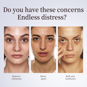 Tianyuan Chinese Herb <strong>HUA</strong> <strong>RONG</strong> SU BRAND MEI TIAN ORAL LIQLID Herbal Supplement Remove Chloasma - Product Image 3