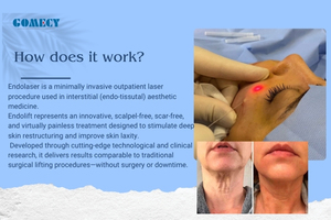 Láser de Diodo Dental 2026 980 1470NM 60w, Láser de Diodo 1470nm 6 en 1 Evlt, <span class=keywords><strong>Precio</strong></span> de Fábrica - Product Image 5