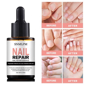 Etiqueta privada Nail Foot Protector Nail Fungus Tratamiento Reparación de uñas para infecciones fúngicas dañadas - Product Image 5
