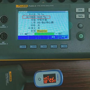 Narigmed SPO2 3% PR 4bpm oxymètre portable à affichage led rouge en gros prix tft capteur d'oxymètre de pouls - Product Image 4