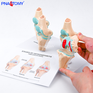 Modelo de Articulación de <span class=keywords><strong>Rodilla</strong></span> Humana de 4 Etapas con Osteoartritis Patológica, Herramienta Educativa para Profesores de Ciencias Anatómicas, Enseñanza Médica - Product Image 6