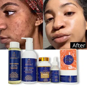 7 Days Results Whitening Cream Lotion Serum Bleaching Skin Soap Gluta Vitamin C Whitening Skin Full Set For Dark Skin