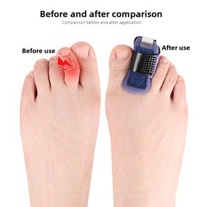 Attelle de pied réglable et fixe pour l'alignement des orteils, redresseur de <span class=keywords><strong>hallux</strong></span> <span class=keywords><strong>valgus</strong></span> portable - Product Image 5