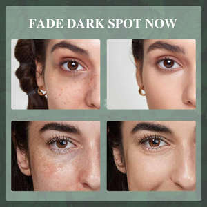 ครีมบำรุงผิวหน้าสูตรส่วนตัว <span class=keywords><strong>ชา</strong></span>เขียวธรรมชาติ วิตามินอีและซี ลดเลือนริ้วรอย ต่อต้านริ้วรอย ไนอะซินาไมด์ ลดจุดด่างดำ - Product Image 6