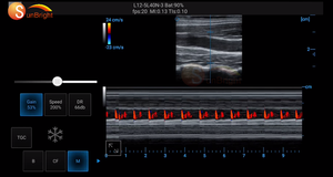 Kleur Doppler 128 Elementen 3 In 1 Draadloze Echografie Usg Sonde Draagbare Ultrasone Scanner - Product Image 3