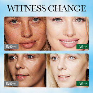 SADOER Nouveaux Produits de Soins de la Peau Gel d'<span class=keywords><strong>Aloe</strong></span> <span class=keywords><strong>Vera</strong></span> Biologique Naturel Hydratant Anti-Âge Rides Visage Apaisant Réparation Gel Facial - Product Image 6