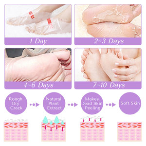 Perawatan Kulit Jepang masker kaki pekerjaan kaki Lavender privat-Label-masker kakinya-Peeling grosir - Product Image 4