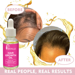 BIOSLLE <span class=keywords><strong>Kit</strong></span> de Soins Capillaires Personnalisé avec Logo : Huile Nourrissante, Cire Coiffante en Stick, Mousse Coiffante, Colle pour Perruques - Product Image 6