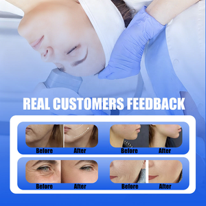 Apparecchiatura Professionale ad Alta Energia per la Bellezza, Ringiovanimento della Pelle, Riduzione Rughe, Rassodamento Viso e Corpo, Certificata CE per Uso Cosmetico - Product Image 5