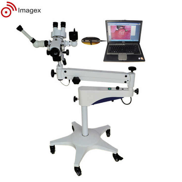 Binocular Colposcope with Built-in Camera Gynecological Surgical ...