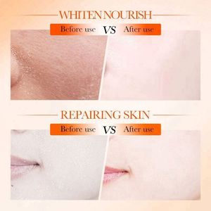 Tónico facial privado Sadoer <span class=keywords><strong>de</strong></span> vitamina C 5 veces concentrada, la mejor esencia coreana blanqueadora e hidratante para el rostro. - Product Image 5
