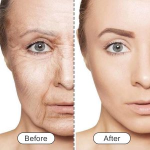 Cerotti Antirughe Notturni, Nastro per Viso, Strisce Pre-Tagliate per Lifting Facciale, Nastro Rassodante per la Pelle per Donne - Product Image 6