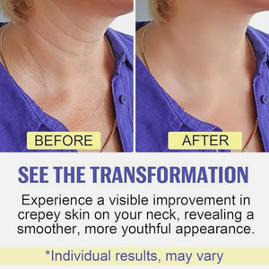 <span class=keywords><strong>Crema</strong></span> para el Cuello de Grado Doméstico Lift & Firm, Origen Shaanxi, Cuidado Personalizado del Cuello para Reducir Arrugas y Mejorar el Contorno del Cuello, Antienvejecimiento - Product Image 4