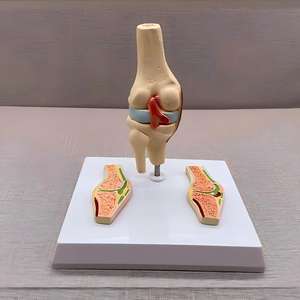 Modelo de Articulación de Rodilla con Artritis Reumatoide - Herramienta Educativa de <span class=keywords><strong>Ortopedia</strong></span> - Product Image 4