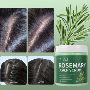 Oem Natuurlijke Rozemarijn Hoofdhuid Scrub Voor Haargroei Verhelderende Exfoliërende Zachte Diepe Schone 340G Rozemarijn Hoofdhuid Scrub - Product Image 3