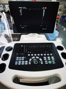 Échographe <span class=keywords><strong>Doppler</strong></span> Couleur Portable Mindray DC-80A 4D 5D – Instruments d'Échographie Médicale pour Hôpitaux - Product Image 5