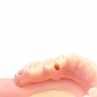 Modèle de démonstration de superstructure dentaire hybride Ecolab Dental All on 6 pour implantologie, certifié ISO pour l'étude dentaire