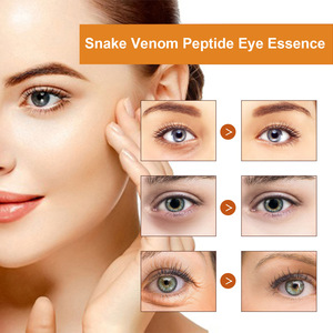 Esencia Antiarrugas <span class=keywords><strong>para</strong></span> el Contorno de Ojos OUHOE, Cuidado Suave Antienvejecimiento, Elasticidad Periocular, Reduce <span class=keywords><strong>las</strong></span> <span class=keywords><strong>Arrugas</strong></span> Finas y <span class=keywords><strong>las</strong></span> Ojeras - Product Image 5