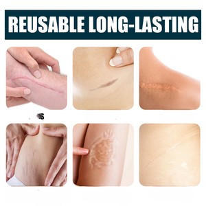 Jaysuing 50ml Crema para Eliminar Cicatrices, Reduce Líneas de Expresión, Tratamiento Avanzado para Cicatrices, Gel para Cicatrices - Product Image 3