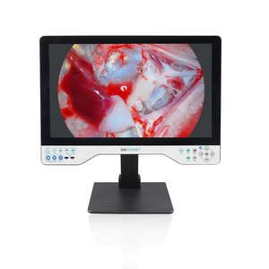 TUYOU Portable HD All-in-One ENT Sistema de fuente de luz de endoscopia Equipo de imágenes médicas - Product Image 6
