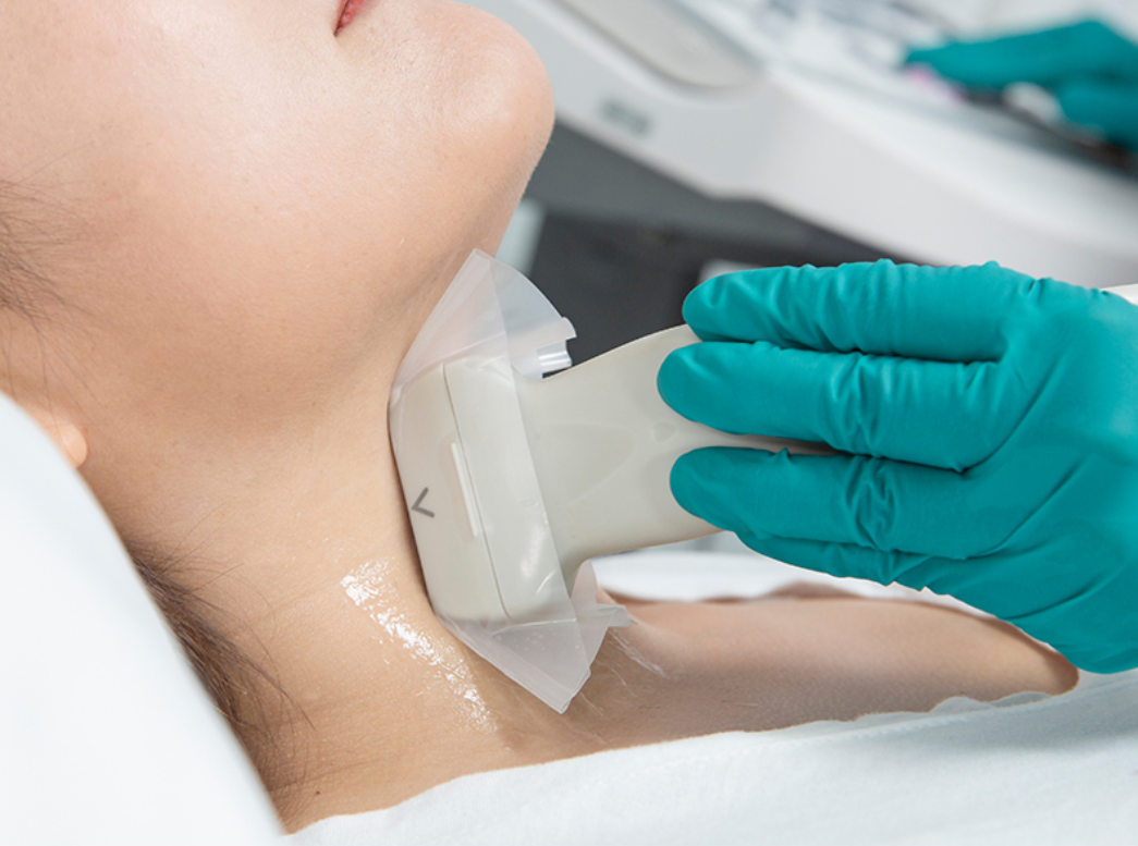 probe cover ultrasound