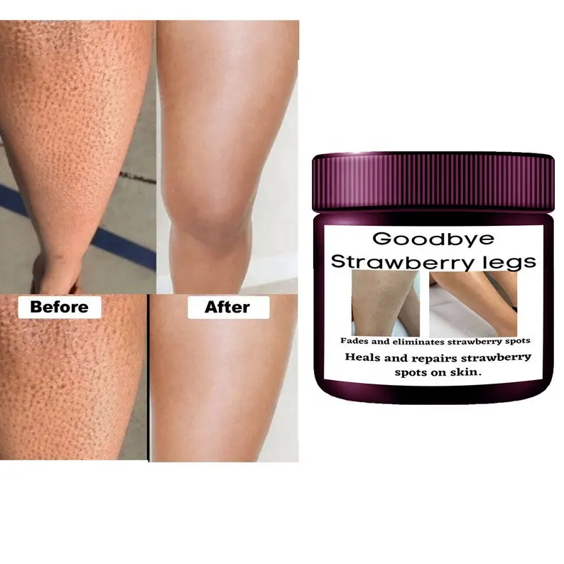 Crème de jambes de fraise de marque privée estompe les taches de fraise sur toute la peau crème exfoliante de jambes de fraise lisse