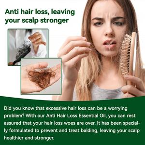 Aceite Chinaherbs para el Crecimiento Rápido del Cabello para Mujeres Indias de Cabello Negro, Aceites Esenciales de Jengibre para el Crecimiento del Cabello, Anti-Caída del Cabello, Marca Privada - Product Image 2