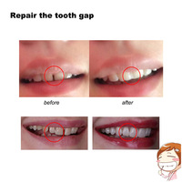 4 couleurs Nouvelle restauration dentaire Faux dents Réparation de dents Perfect Smile Facettes Comfort Fit Flex Dentiers Bretelles Adhésifs Colle
