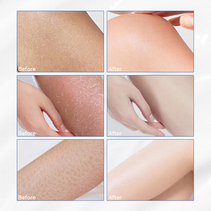 <span class=keywords><strong>Crème</strong></span> hydratante et exfoliante légère, non grasse, réparatrice, à la formule 40% d'<span class=keywords><strong>urée</strong></span>, avec logo personnalisé - Product Image 6
