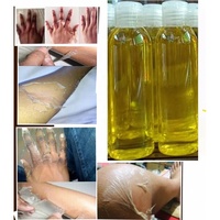 Huile de peeling jaune à étiquette privée, huile de peeling jaune extra forte, exfoliante, blanchissante, pour peaux foncées