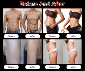 Equipo Profesional de Contorno Corporal Popular para Levantamiento de Glúteos con 2 Manijas Elim Neo S para el Cuidado y Modelado Corporal - Product Image 6