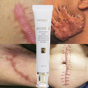 2025 nuevo DuoYan Herbal Gel REPARADOR DE LA PIEL eficaz acné Natural marca de espinillas estrías crema para eliminar cicatrices - Product Image 1
