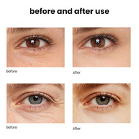CLOVER RENA Patchs pour les yeux en feuille de cristal bleu organique avec peptide de cuivre et acide hyaluronique, anti-âge, anti-poches, anti-cernes, hydratant