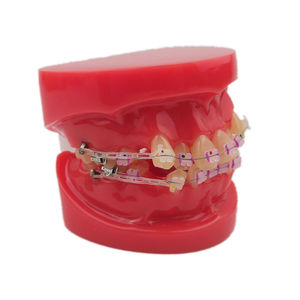 Modelo de Demostración de Ortodoncia Dental con 24 Piezas de Brackets de Cerámica - Product Image 5