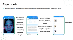 Machine d'analyse cutanée IA X5Pro, 36 millions de pixels, détection des problèmes de peau, analyse de l'hydratation et de l'acné de tous les types de peau - Product Image 5