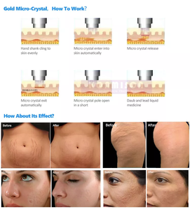 Médecine esthétique Or  Rf <span class=keywords><strong>Microneedling</strong></span> <span class=keywords><strong>Machine</strong></span> professionnelle de <span class=keywords><strong>microneedling</strong></span> RF pour le lifting du visage et l'élimination des rides et des vergetures - Product Image 3