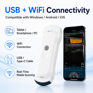 Sonda USB WiFi 3 en 1 para Uso Veterinario Clínico, Ecógrafo <span class=keywords><strong>Doppler</strong></span> Color Portátil - Product Image 2
