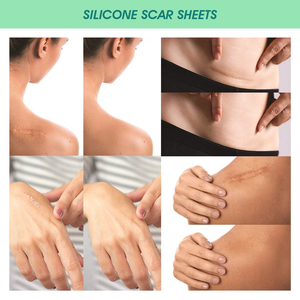 Elaimei Gel réparateur et cicatrisant, Patch en silicone auto-adhésif <span class=keywords><strong>pour</strong></span> cicatrices, vergetures, brûlures, accouchement par césarienne, Soin de beauté - Product Image 6