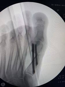 Équipement d'imagerie médicale compact pour la podologie et l'usage vétérinaire, appareil de radiographie portable - Product Image 3