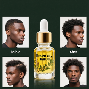 100% naturel soin du cuir chevelu bio romarin huile de ricin élixir de croissance sérum de densité - Product Image 5