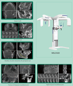 Kỹ Thuật Số nha khoa opg toàn cảnh 3D x Ray tomographic hệ thống nha khoa kỹ thuật số cbct 3D toàn cảnh nha khoa cephalometric x Ray máy - Product Image 2