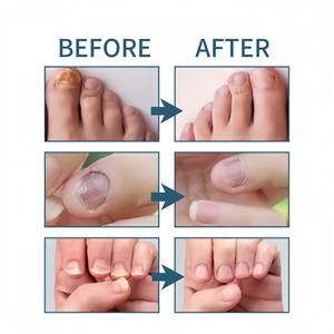 Suero Antifúngico Sylax de 30 ml para Nutrición Profunda, Tratamiento de Hongos <span class=keywords><strong>en</strong></span> las Uñas, Reparación de Uñas y Restauración de Uñas Saludables - Product Image 6