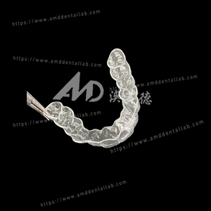 Retainer orthodontique personnalisé pour l'extérieur de laboratoire dentaire – Compatible STL ou modèle dentaire pour laboratoire dentaire (types Hawley, Clear, <span class=keywords><strong>Essix</strong></span>) - Product Image 4